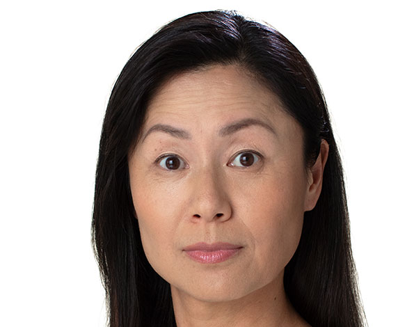 Mimi_Forehead_Before Botox®