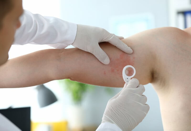 Dermatologist examining rash on patient