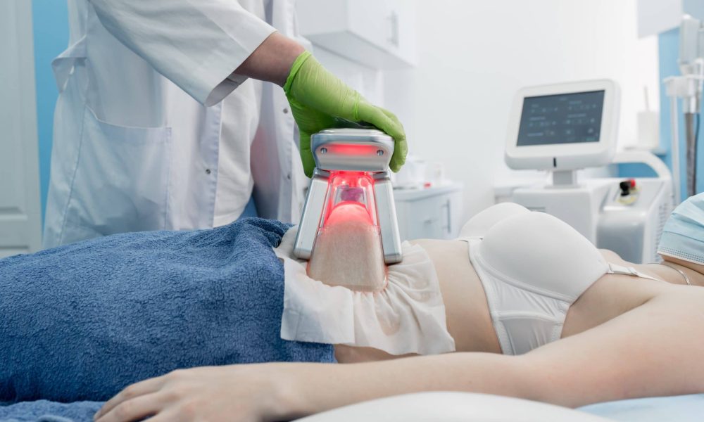 CoolSculpting - A Cosmetic Treatment that Removes Excess Fat in Stubborn Areas